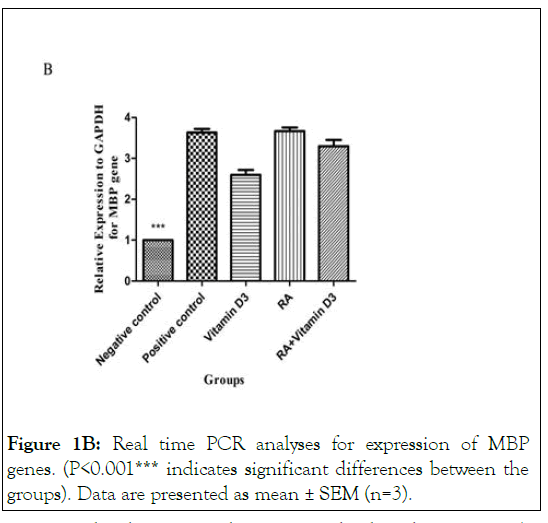 leukemia-expression