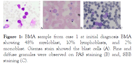 leukemia-lymphoblasts