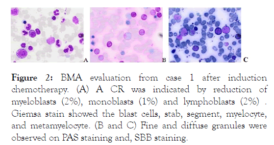 leukemia-reduction