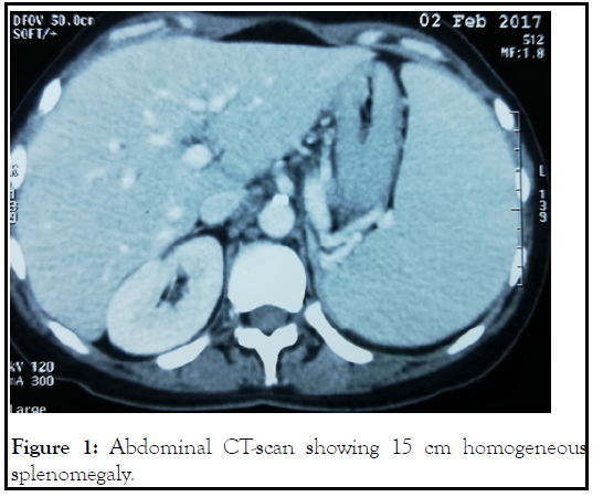 leukemia-splenomegaly