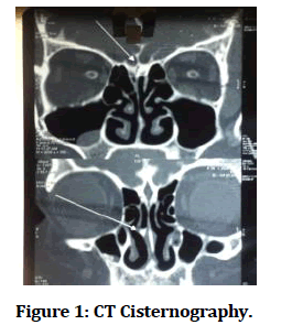 medical-dental-Cisternography