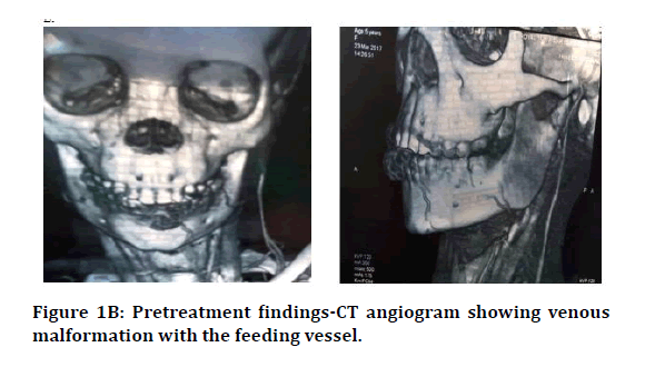 medical-dental-feeding-vessel