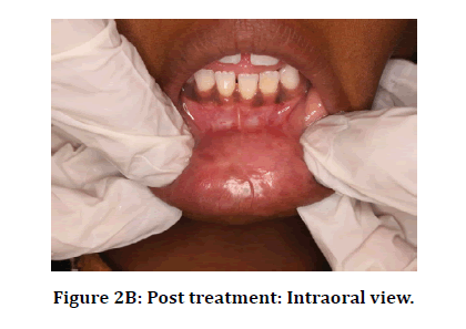 medical-dental-intraoral-view