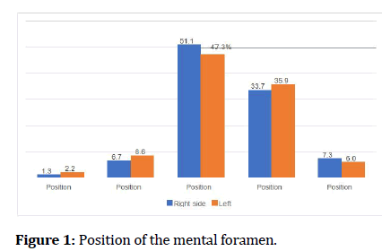 medical-dental-mental-foramen