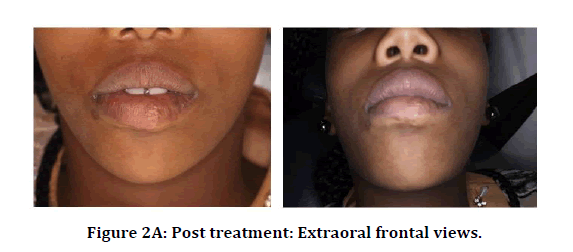 medical-dental-post-treatment