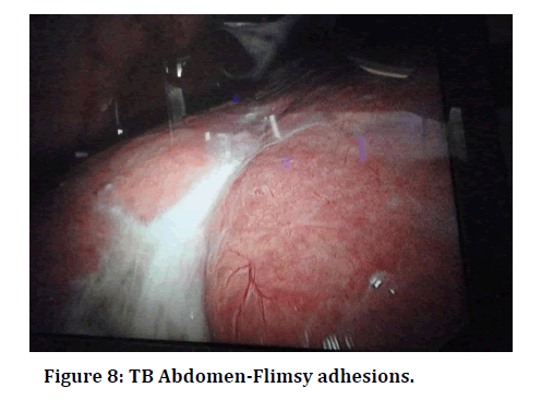 medical-dental-science-Abdomen-Flimsy