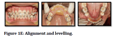 medical-dental-science-Alignment-levelling