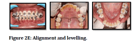 medical-dental-science-Alignment-levelling