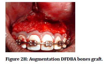 medical-dental-science-Augmentation