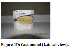 medical-dental-science-Cast-model