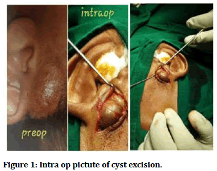 medical-dental-science-Intra-pictute