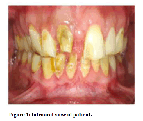 medical-dental-science-Intraoral-view