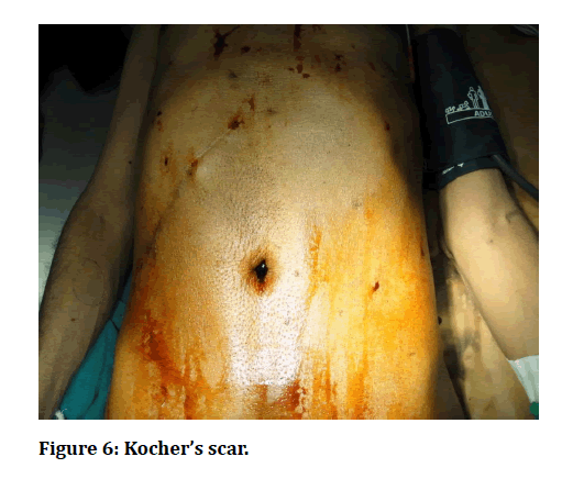 medical-dental-science-Kochers-scar