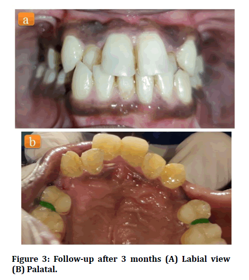 medical-dental-science-Labial-view