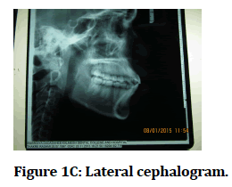 medical-dental-science-Lateral-cephalogram