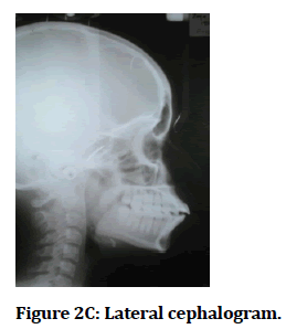 medical-dental-science-Lateral-cephalogram