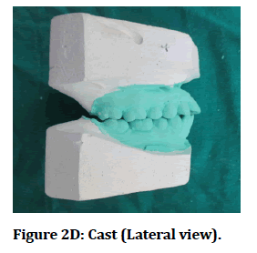 medical-dental-science-Lateral-view