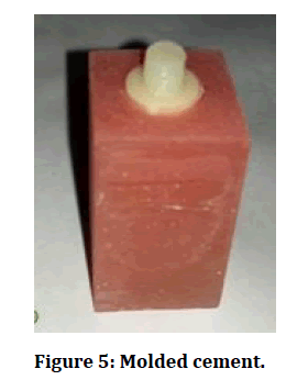 medical-dental-science-Molded-cement