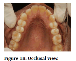 medical-dental-science-Occlusal-view
