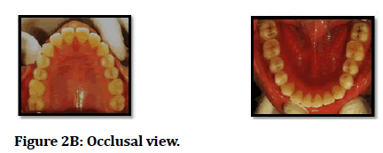 medical-dental-science-Occlusal-view