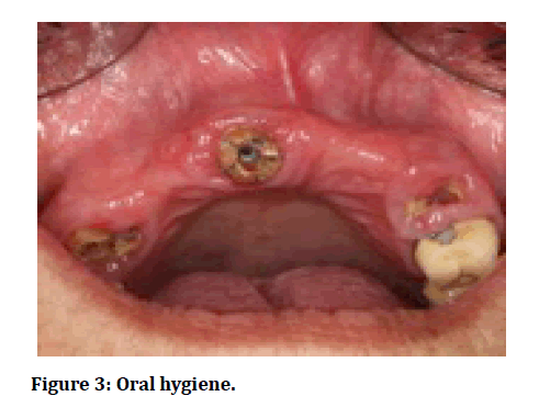 medical-dental-science-Oral-hygiene