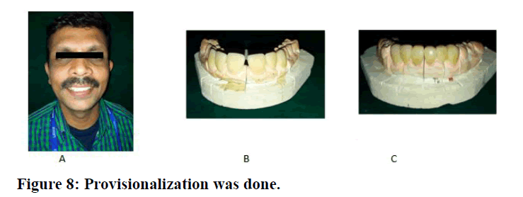 medical-dental-science-Provisionalization