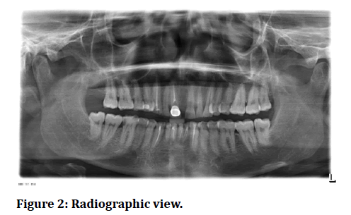 medical-dental-science-Radiographic-view