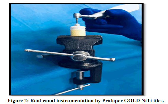 medical-dental-science-Root-canal