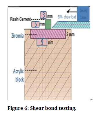 medical-dental-science-Shear-bond