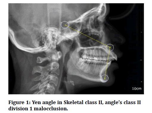 medical-dental-science-Skeletal-class