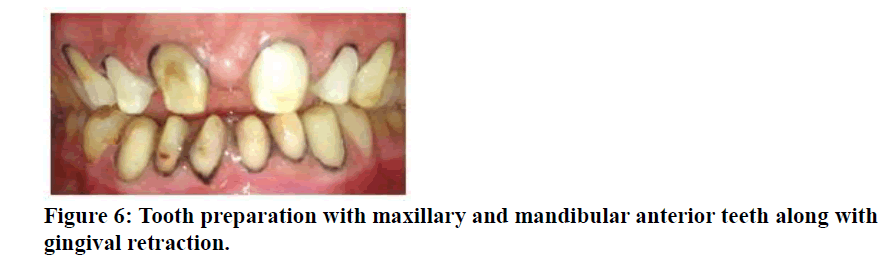 medical-dental-science-Tooth-preparation