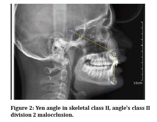 medical-dental-science-Yen-angle