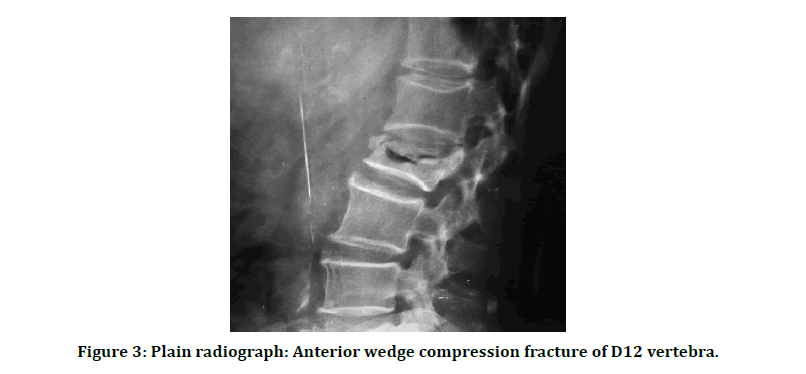 medical-dental-science-anterior-wedge