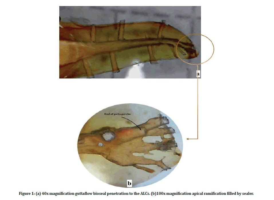 medical-dental-science-bioseal-penetration