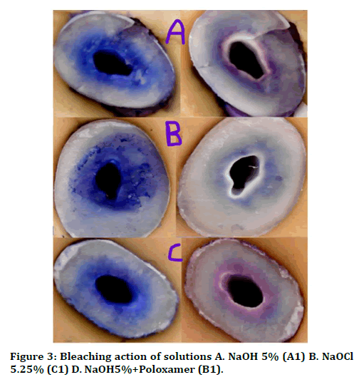 medical-dental-science-bleaching-action