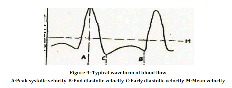 medical-dental-science-blood-flow