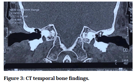 medical-dental-science-bone