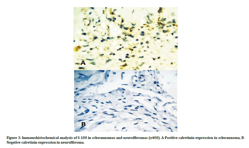 medical-dental-science-calretinin-expression