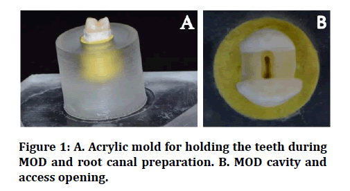 medical-dental-science-canal-preparation