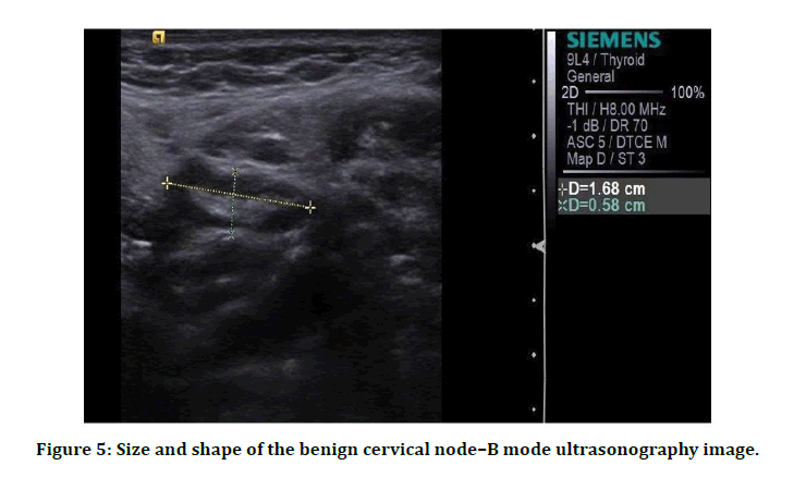 medical-dental-science-cervical-node