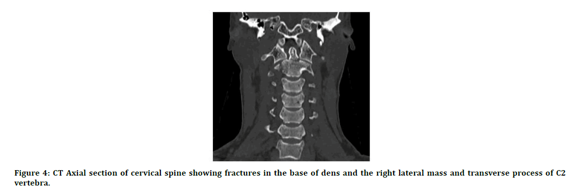 medical-dental-science-cervical-spine