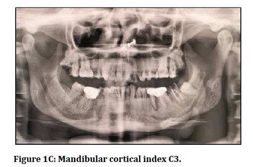 medical-dental-science-cortical-index