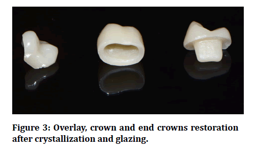 medical-dental-science-crowns-restoration