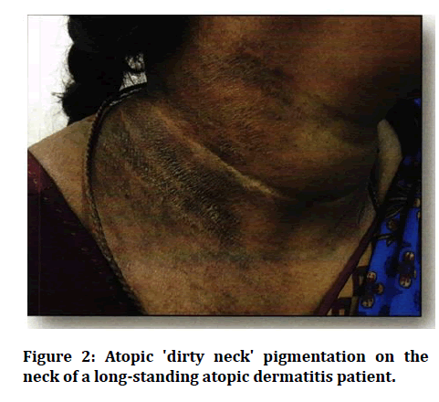 medical-dental-science-dirty-neck