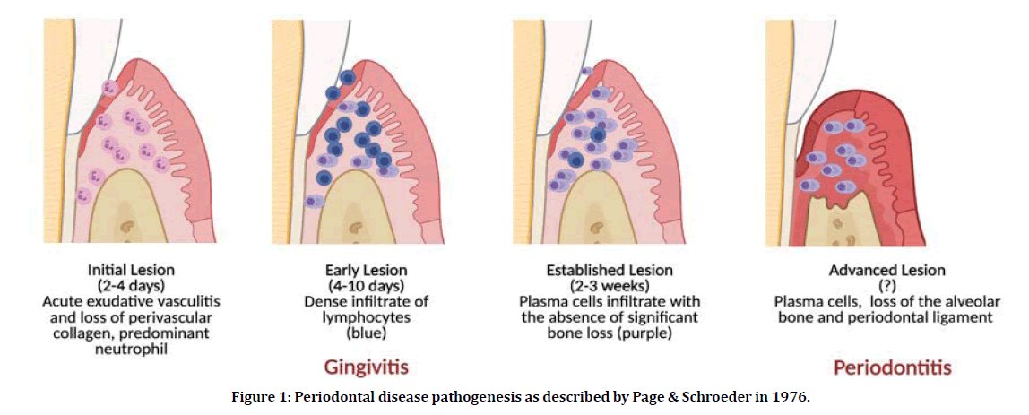 medical-dental-science-disease-pathogenesis