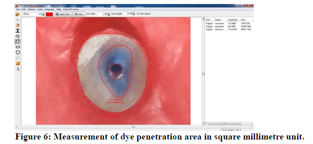 medical-dental-science-dye-penetration