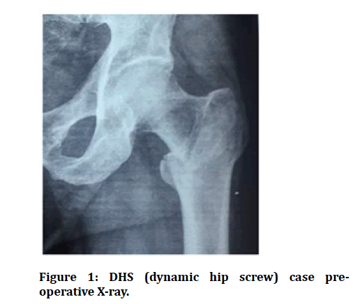 medical-dental-science-dynamic-hip