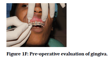 medical-dental-science-evaluation-gingiva