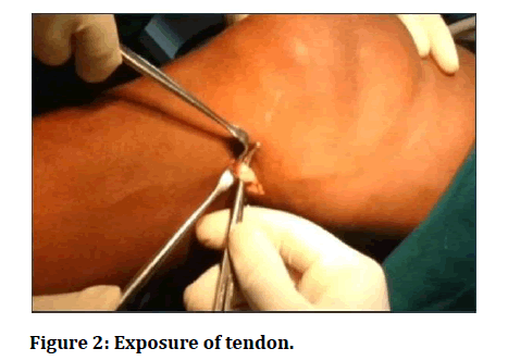medical-dental-science-exposure-tendon