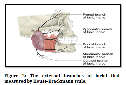 Mandibular nerve - Gross Anatomy 